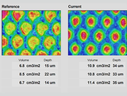 Anilox-Reinigungsbericht
